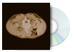 Molecular Imaging in Drug Discovery and Development